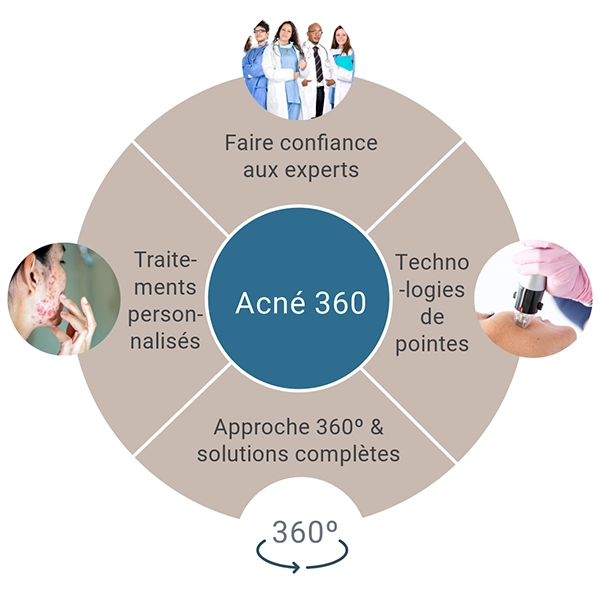 Programme de traitement Acné 360